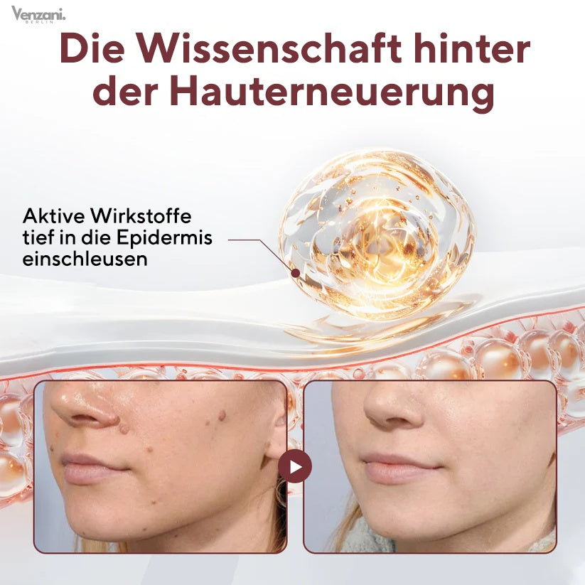 Cvreoz® KeraErase Dual-Action Renewal Cream - Die Kraft des schwarzen Reises gegen raue Stellen