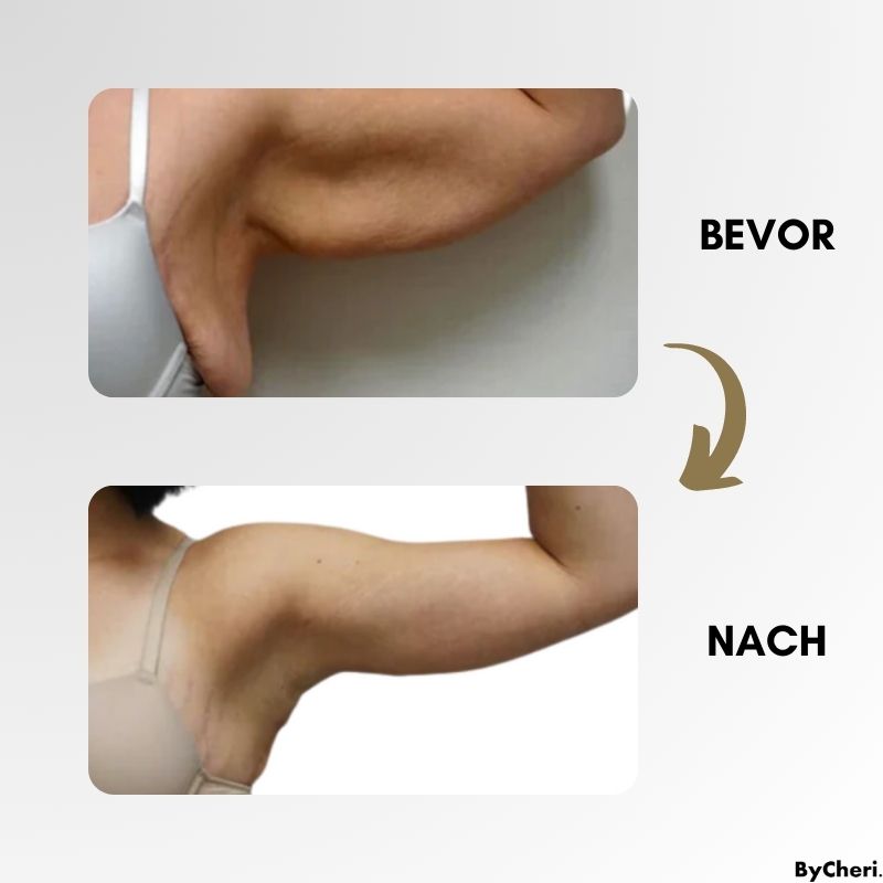 LETZTER TAG 50% RABATT | LymphMag™ | Fühlen Sie sich in Wochen anders