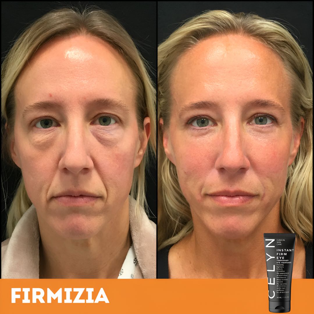 Firmizia™ - Sofortige Anti-Falten- und Augenringe-Creme