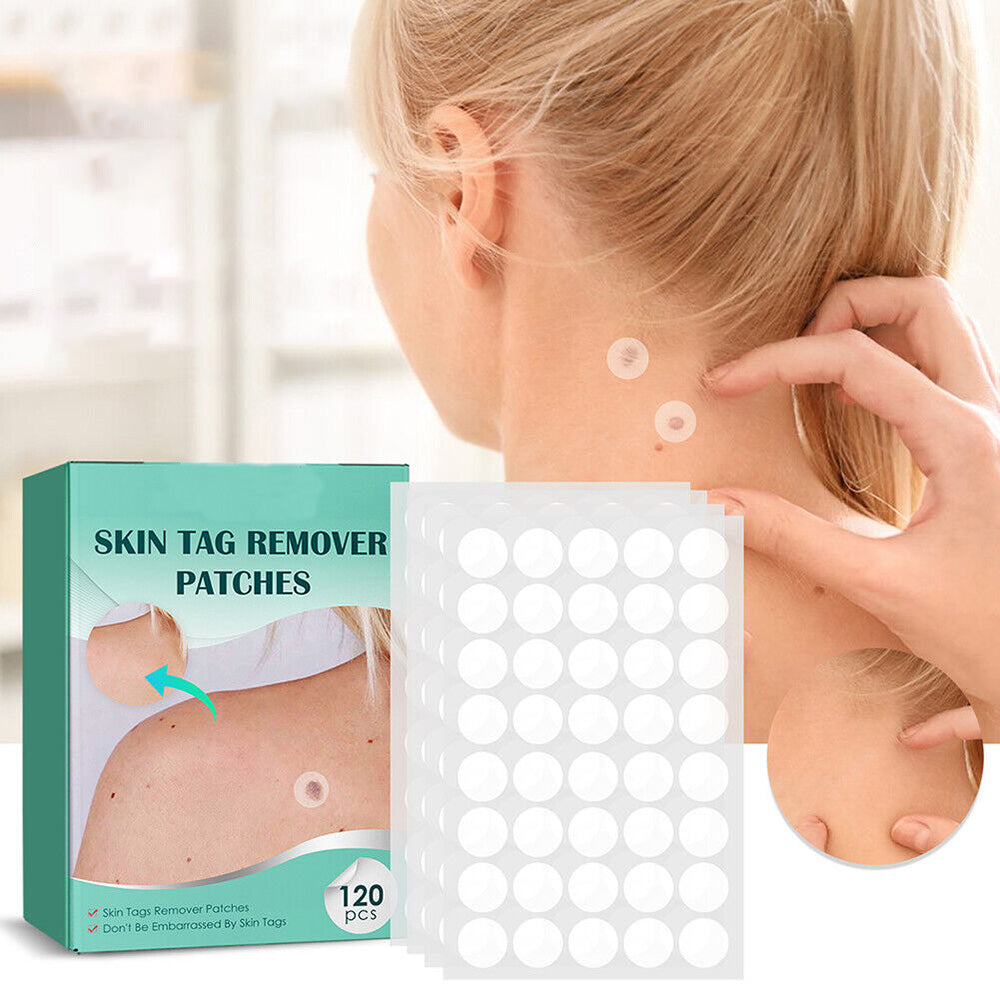 Ripob | SkinClear Hautwarzenentferner | Pflaster zur Entfernung von Hautwarzen & Warzen | Hydrocolloid-Technologie | Schmerzfrei & Diskret | Für alle Hauttypen geeignet | 144 Stück
